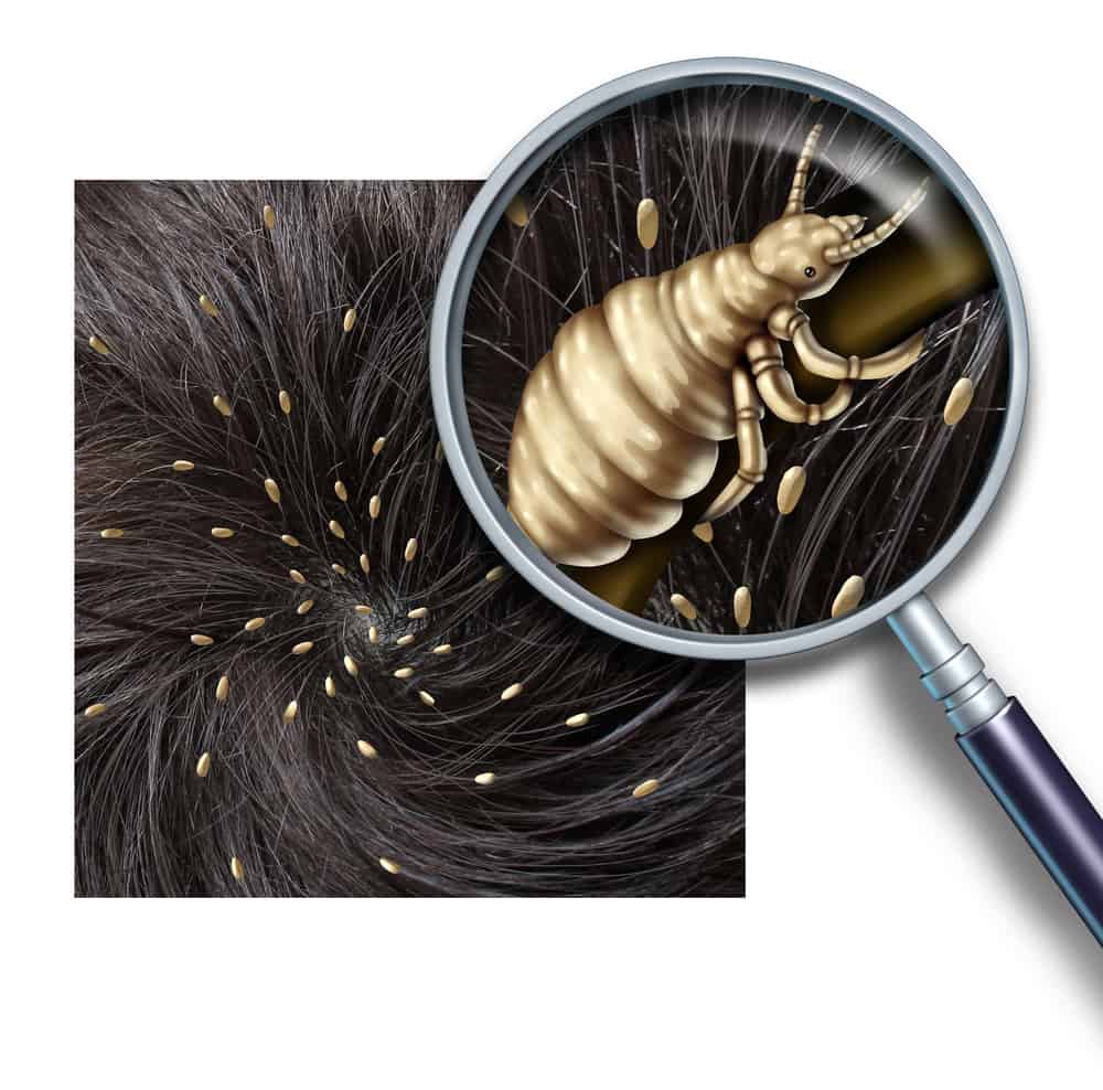 types-of-lice