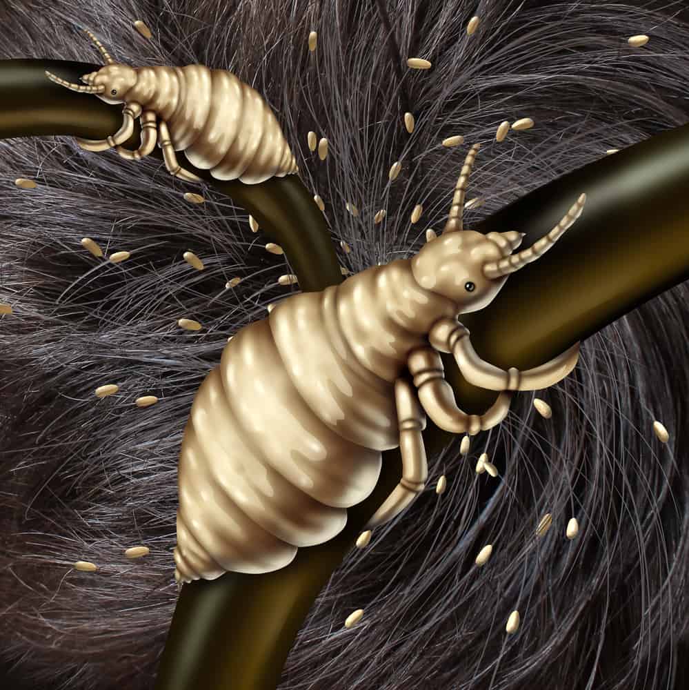 facts about head lice
