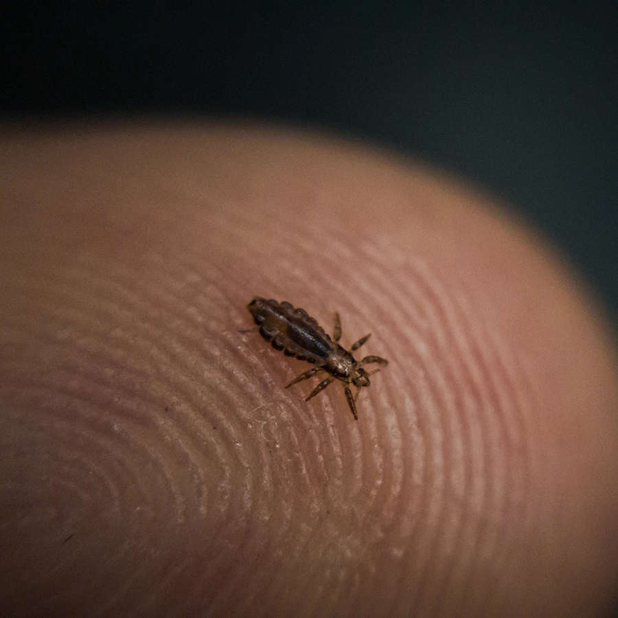 close up image of fully grown louse on human finger - size comparison - St. Charles, MO