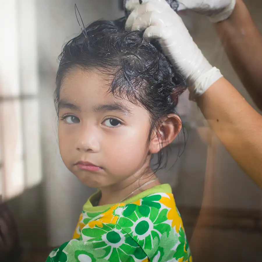 Hispanic little girl is miserable because of lice treatment, old, harmful treatment methods - St. Charles, MO